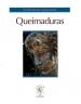 Queimaduras