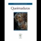 Queimaduras