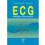 ECG - Avaliação e Interpretação
